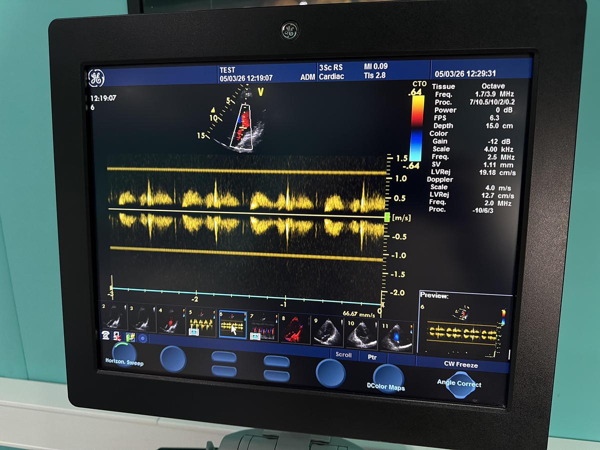 Gebraucht GE Vivid S6 Ultraschallgerät mit 3Sc-RS kardio Sonde