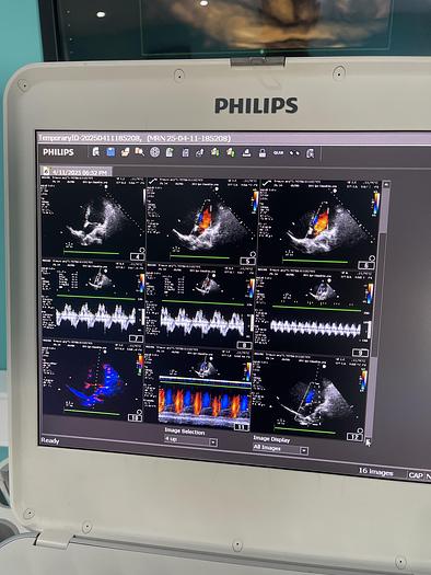 Gebraucht Philips CX50 Ultraschallgerät mit Sektor Sonde Model Version 5.0.2