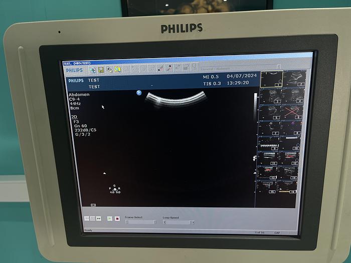 Used Philips HD 11 XE  Ultraschallgerät mit drei Sonden und Drucker
