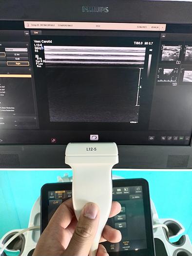 Gebraucht Philips  Affiniti 70G Screen Ultrasound Scanner 