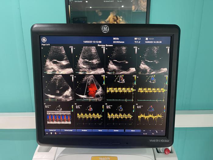 Gebraucht GE Vivid E9 XDclear Ultraschallgerät mit zwei Sonden #2015 