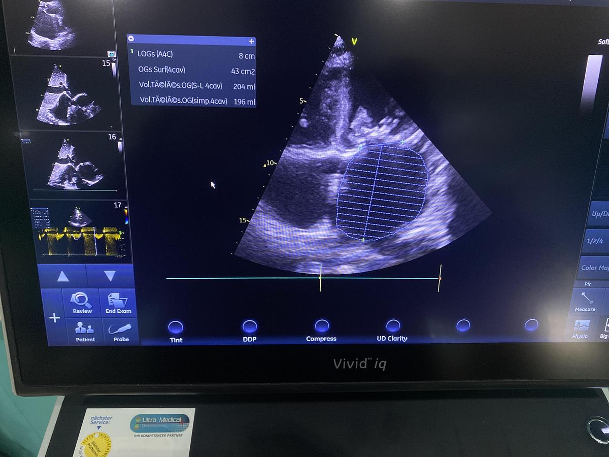Gebraucht GE Vivid iq Ultraschallgerät mit M5Sc-RS Kardiosonde