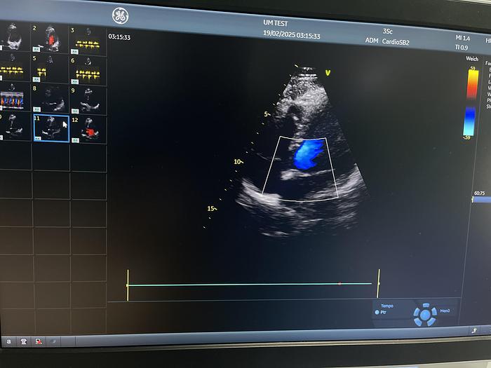 Gebraucht GE 3SC-RS Sektor Ultraschallsonde 