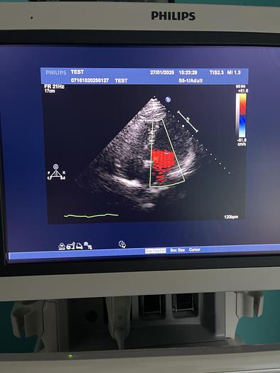 Used Philips iE33 HW G.1  xMatrix Ultraschallgerät mit S5-1 Kardiosonde und Drucker