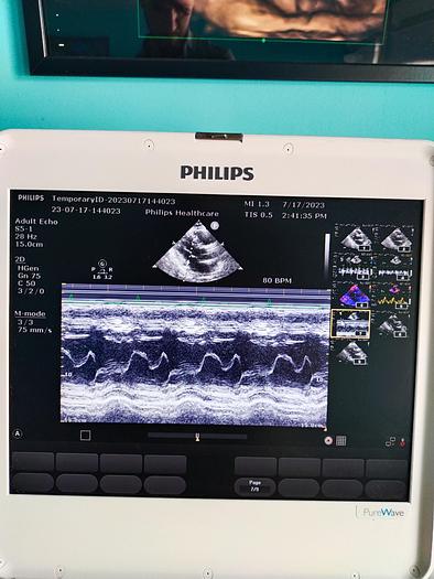 Gebraucht Philips CX50 Ultrasound with S5-1 and Trolly