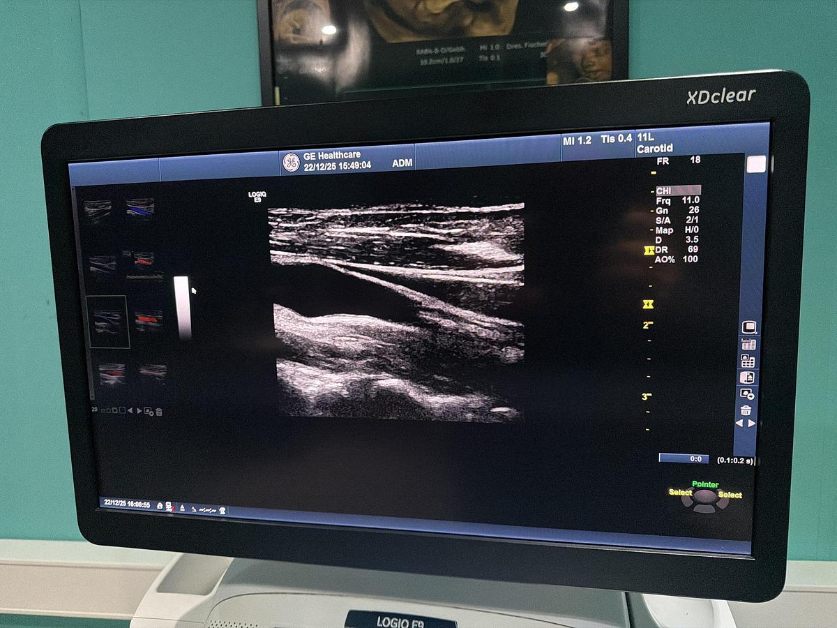 Gebraucht GE LOGIQ E9 XDClear Elastography Ultraschallgerät mit zwei Sonden  