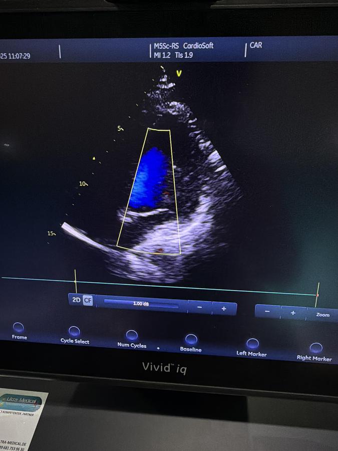 Gebraucht GE M5Sc-RS Kardio Ultraschallsonde