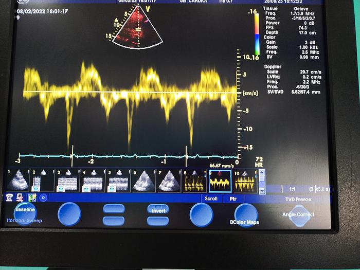 Gebraucht GE Vivid S5 Ultraschallgerät