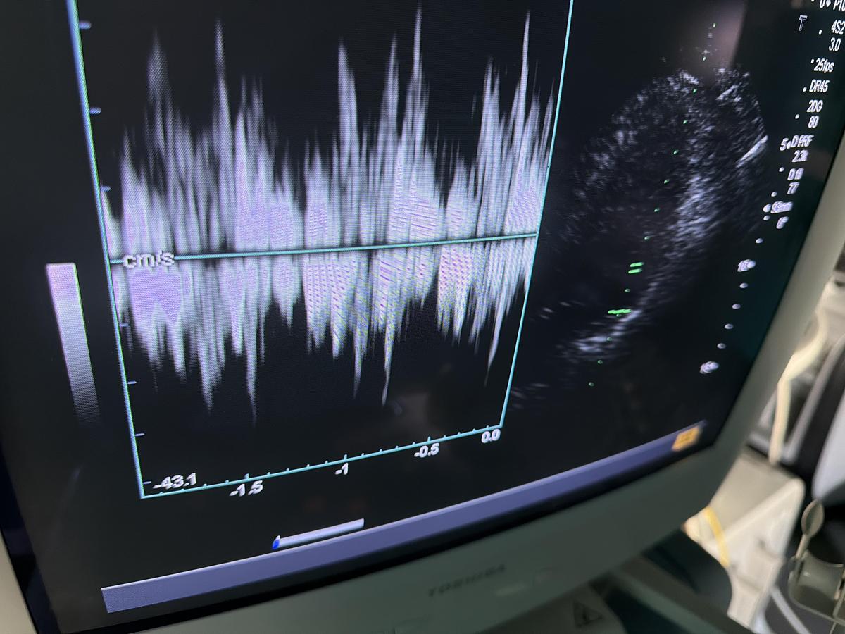 Gebraucht Toshiba PSM-25AT
