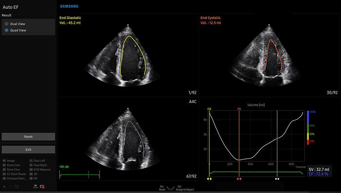 Samsung V8 Ultraschallsystem