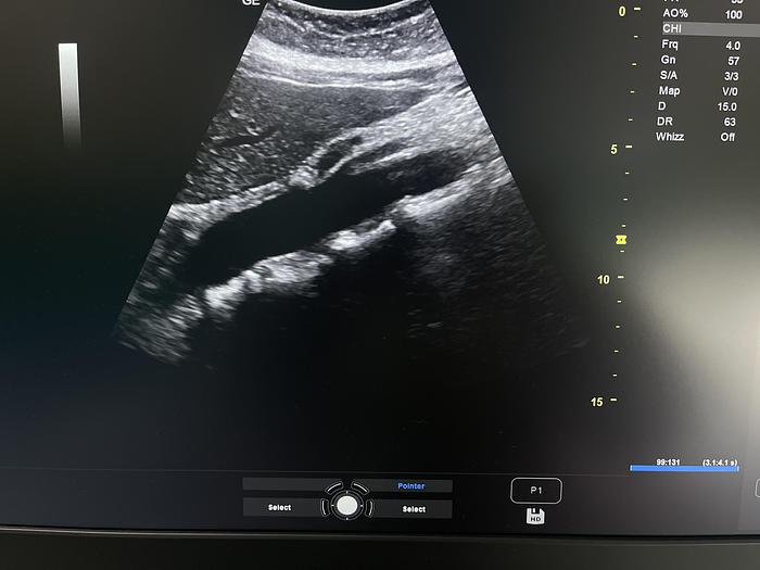 Gebraucht GE Versana Premier Ultraschallgerät mit drei Sonden