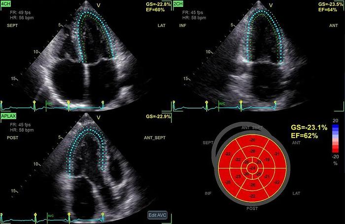 GE Vivid S70N Ultra Edition überholtes Ultraschallsystem