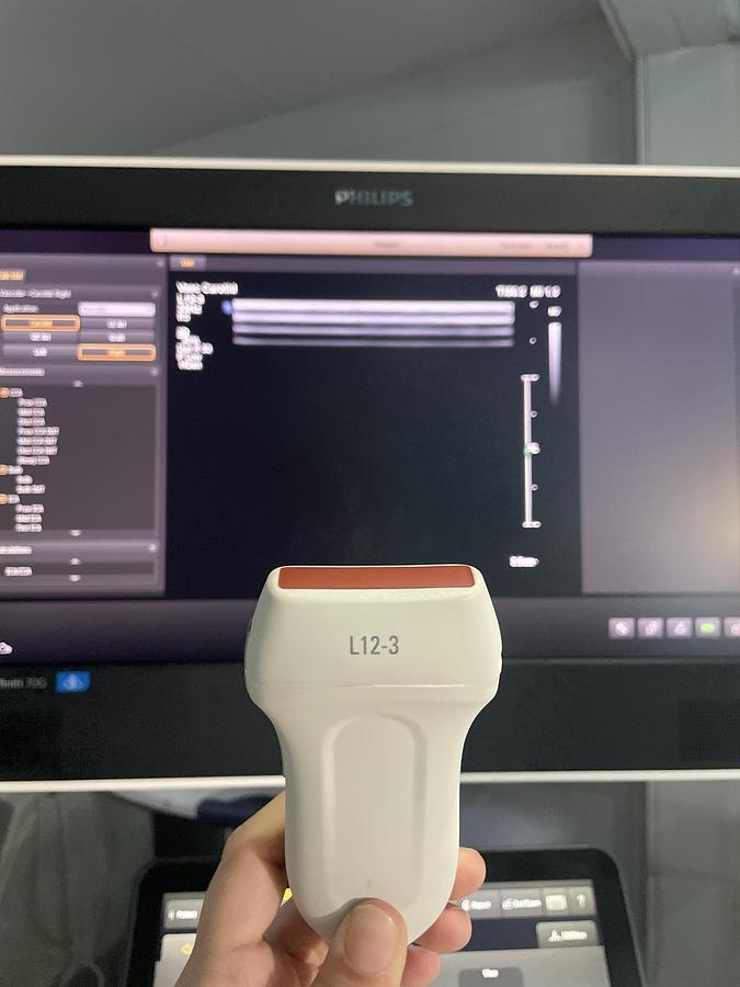 Gebraucht Philips L12-3 Linear Ultraschallsonde 