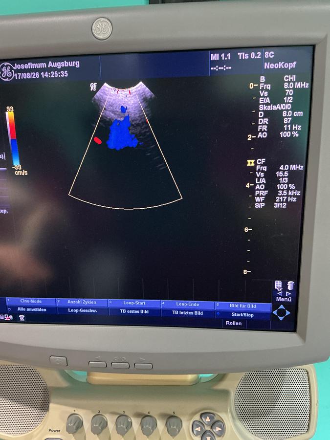 Gebraucht GE Logiq P5 Ultraschallgerät mit zwei Sonden
