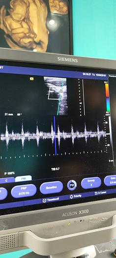 Gebraucht Siemens Acuson X300 Ultraschallgerät mit 3 Sonden