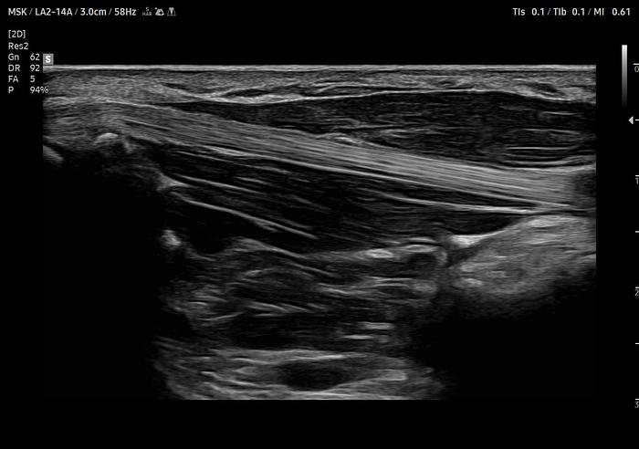 Samsung V8 Ultraschallsystem