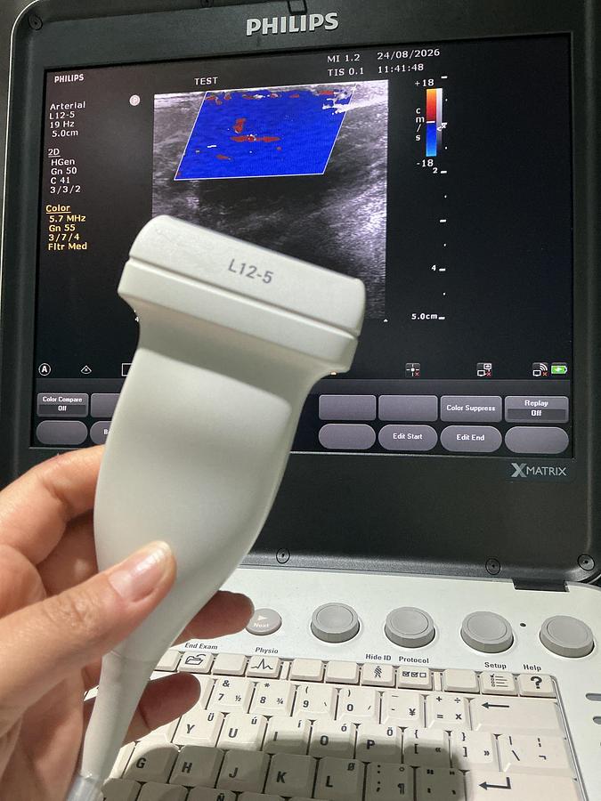 Gebraucht Philips L12-5 compact Linear Ultraschallsonde