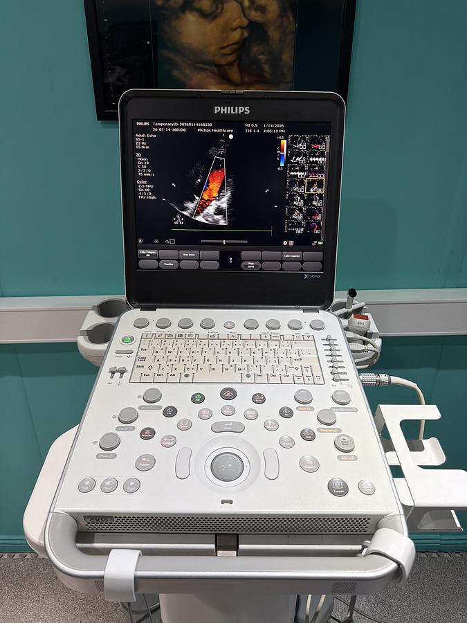 Gebraucht Philips CX50 XMATRIX HW E.0 SW 5.5.3 Ultraschallgerät mit zwei Sonden