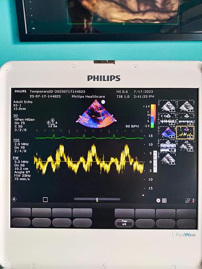 Gebraucht Philips CX50 Ultrasound with S5-1 and Trolly