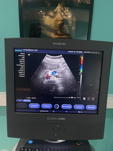 Used Siemens ACUSON X300 Ultraschallgerät mit drei Sonden 