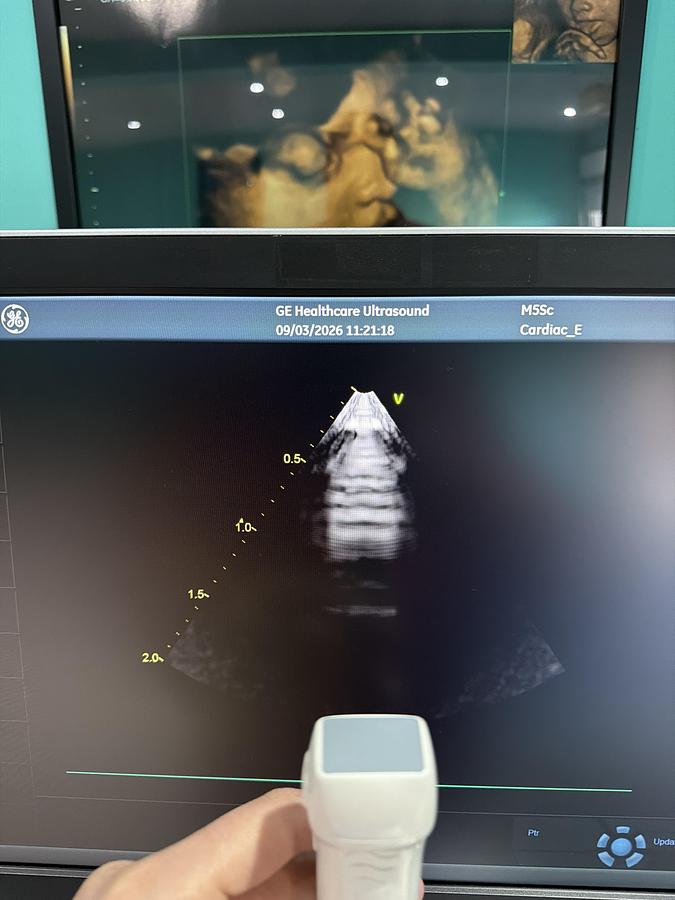 Gebraucht Vivid S70N Ultrasound 