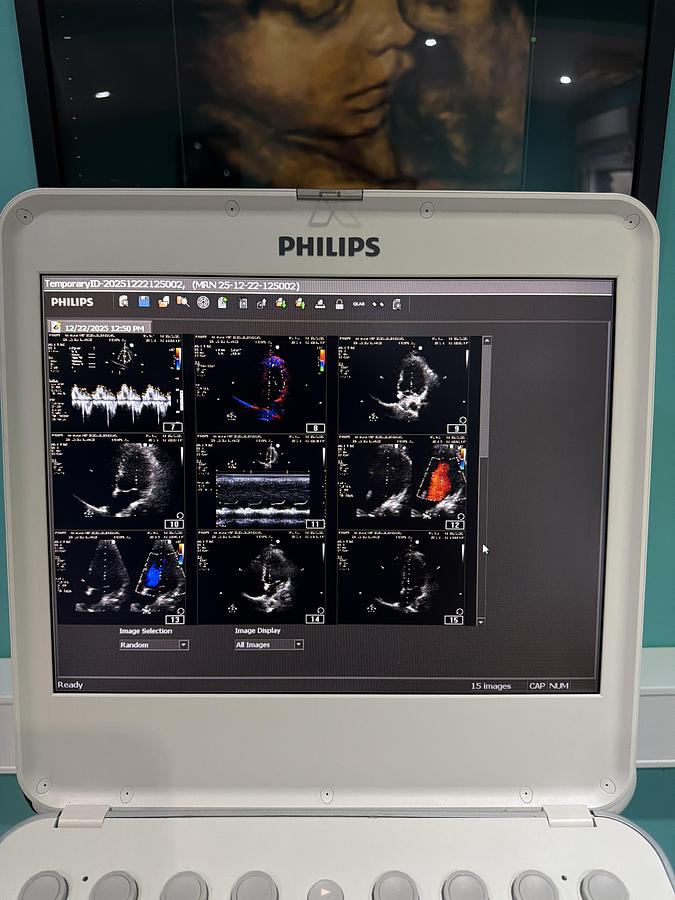 Gebraucht Philips CX50 Ultraschallgerät mit S5-1 Kardiosonde
