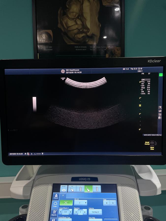 Gebraucht GE C2-9-D Konvex Ultraschallsonde 