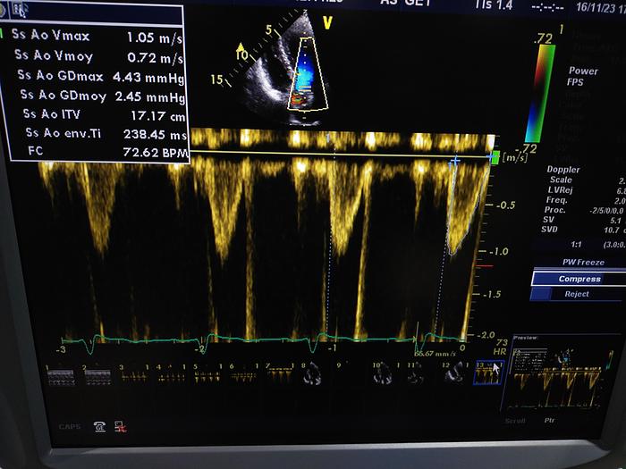 Gebraucht GE Vivid 7 Ultraschallgerät