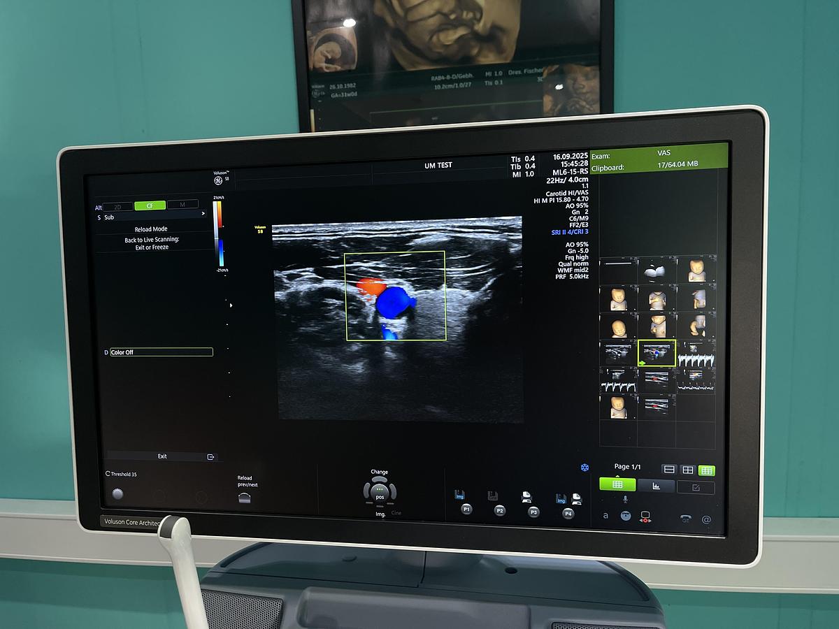 Gebraucht GE Voluson S8 Ultraschallgerät mit drei Sonden und Drucker