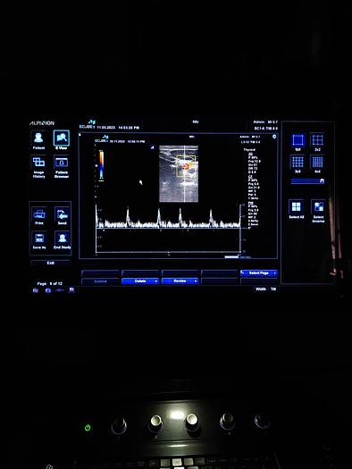 Gebraucht Alpinion E cube 9 Ultraschallgerät SW 2.6 mit 2 Sonde