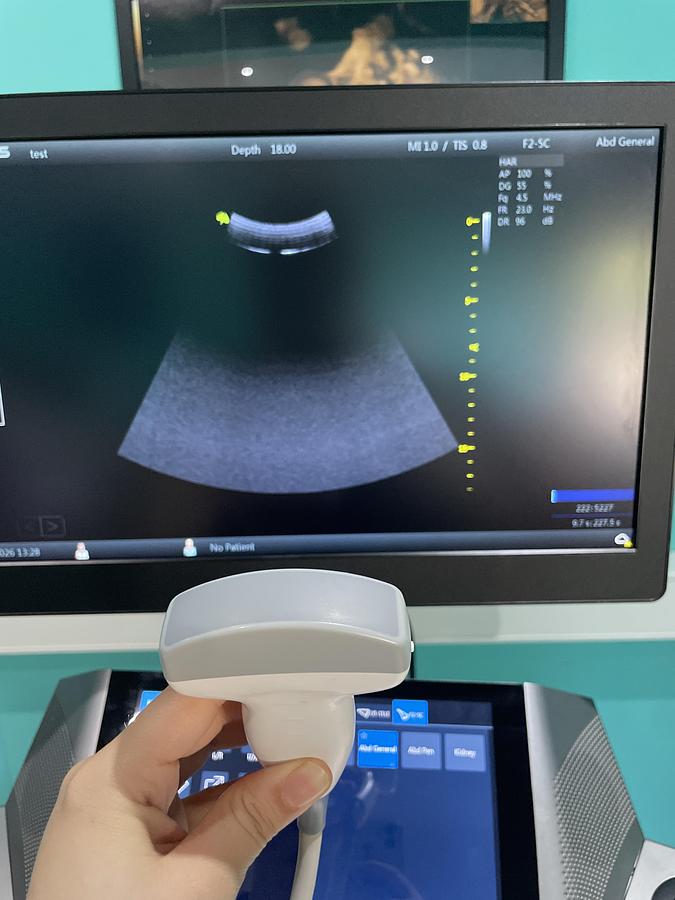 Gebraucht VINNO G55 Ultraschallgerät mit zwei Sonden und Drucker