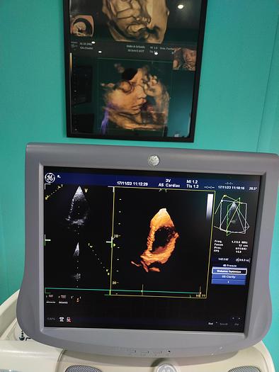 Gebraucht GE Vivid 7 Ultraschallgerät