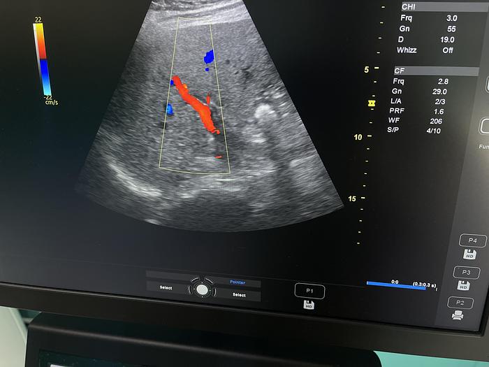 Gebraucht GE Versana Premier Ultraschallgerät mit drei Sonden