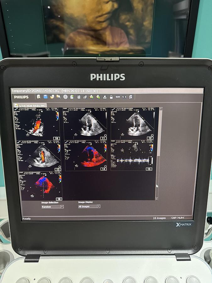 Gebraucht Philips CX50 XMATRIX HW E.0 SW 5.5.3 Ultraschallgerät mit zwei Sonden