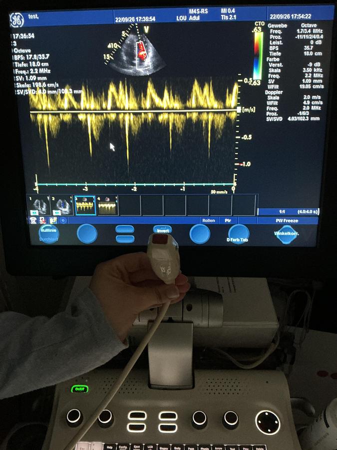 Gebraucht GE 10S-RS Kardio Ultraschallsonde