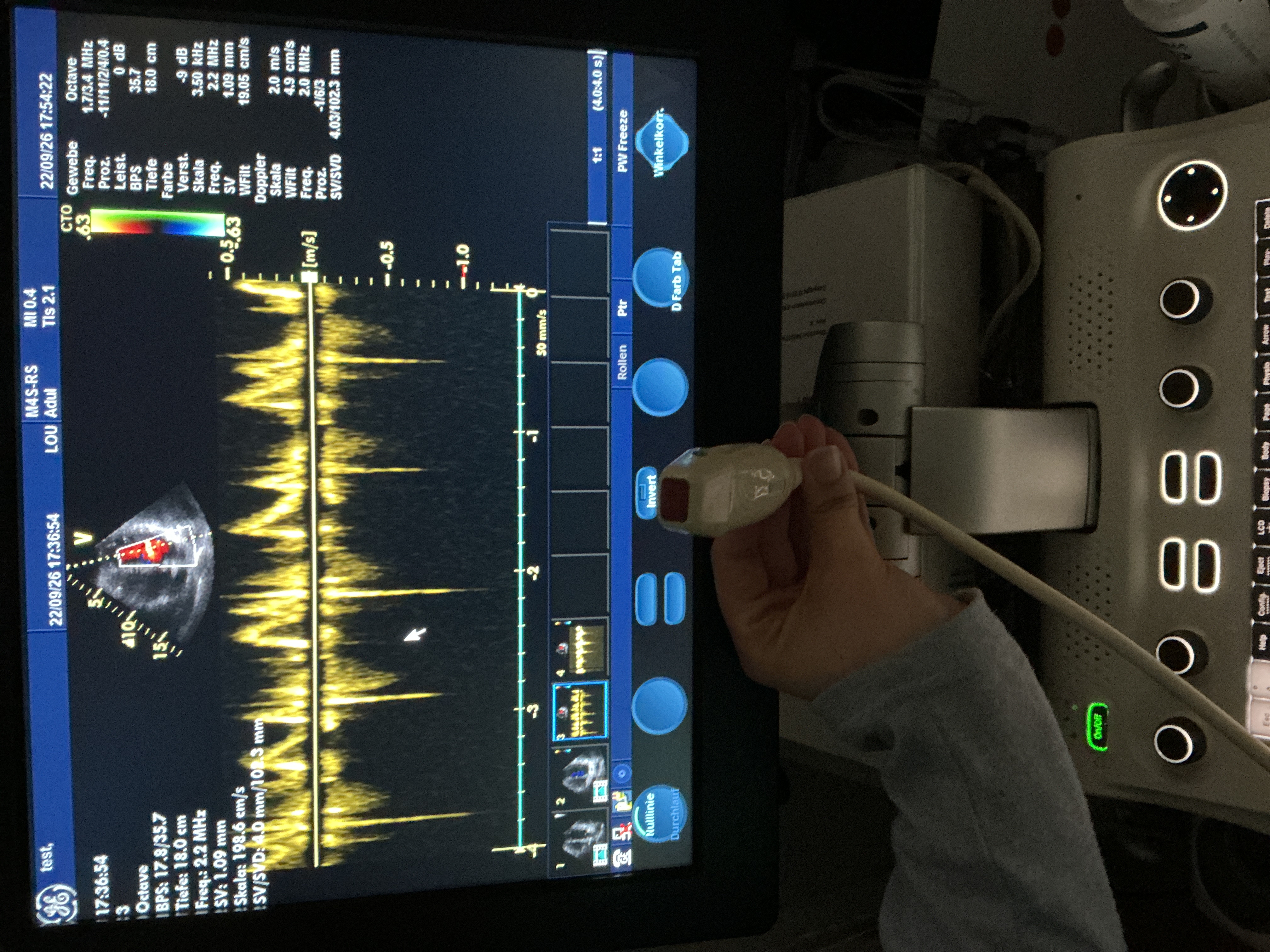 Gebraucht GE 10S-RS Kardio Ultraschallsonde