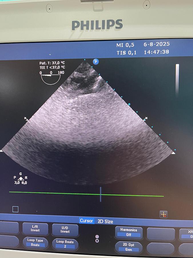 Gebraucht Philips X7-2t TEE Sonde