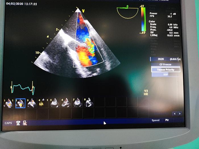 Gebraucht GE Vivid 7 Ultraschallgerät
