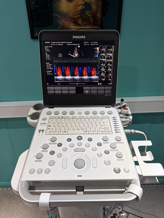 Gebraucht Philips CX50 XMATRIX HW E.0 SW 5.5.3 Ultraschallgerät mit zwei Sonden