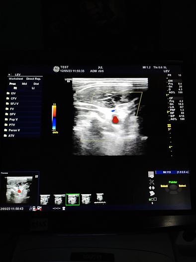 Gebraucht GE LOGIQ E9 Flachbildschirm-Ultraschallgerät inkl. 1 Sonde, Drucker und DVD-Brenner