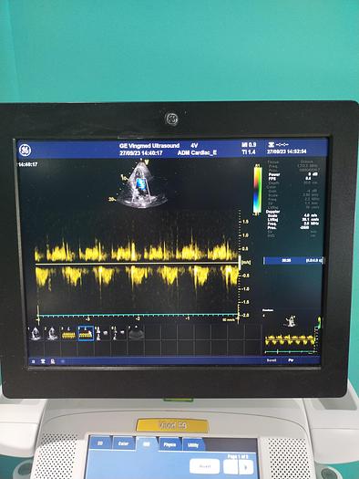 Gebraucht GE Vivid E9 Ultraschallgerät