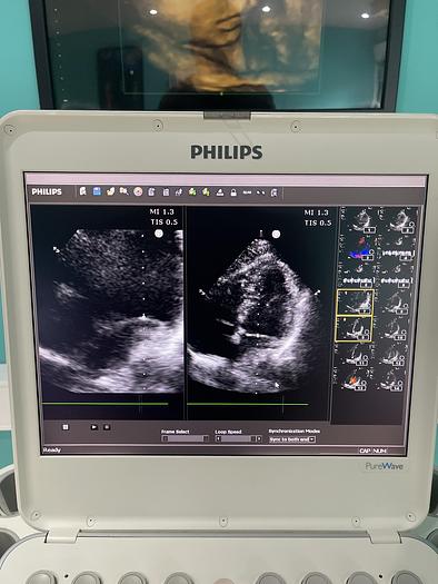 Gebraucht Philips CX50 Ultraschallgerät HW C.0 mit Sektor Sonde