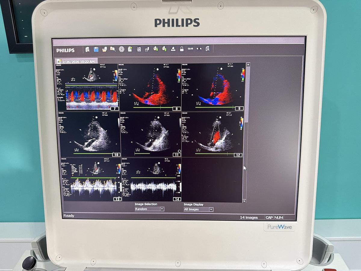 Gebraucht Philips CX50 Ultraschallgerät mit Sonde S5-1 auf Trolley
