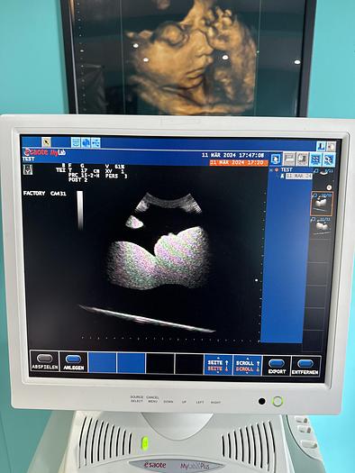 Gebraucht Esaote MyLab20Plus Ultraschallgerät mit drei Sonden
