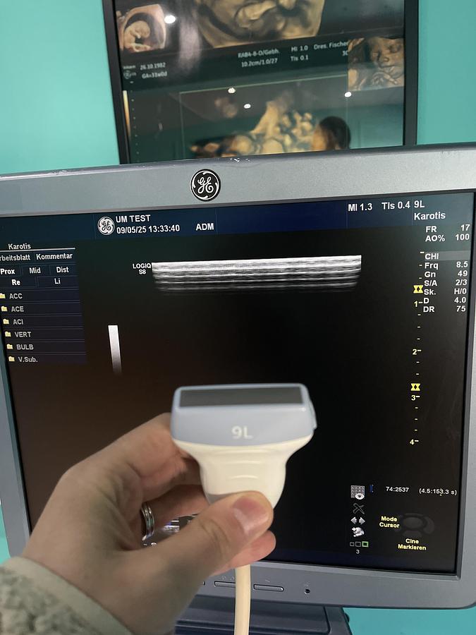 Used GE LOGIQ S8 Ultraschallgerät mit M5S-D kardio Ultraschallsonde und Drucker