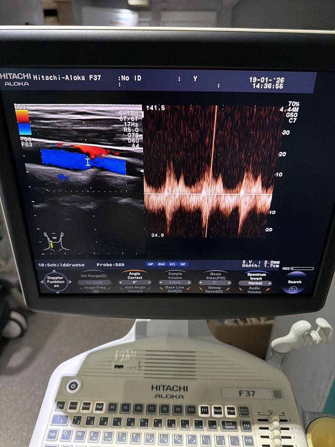 Gebraucht Aloka UST-568 Linear Ultraschallsonde