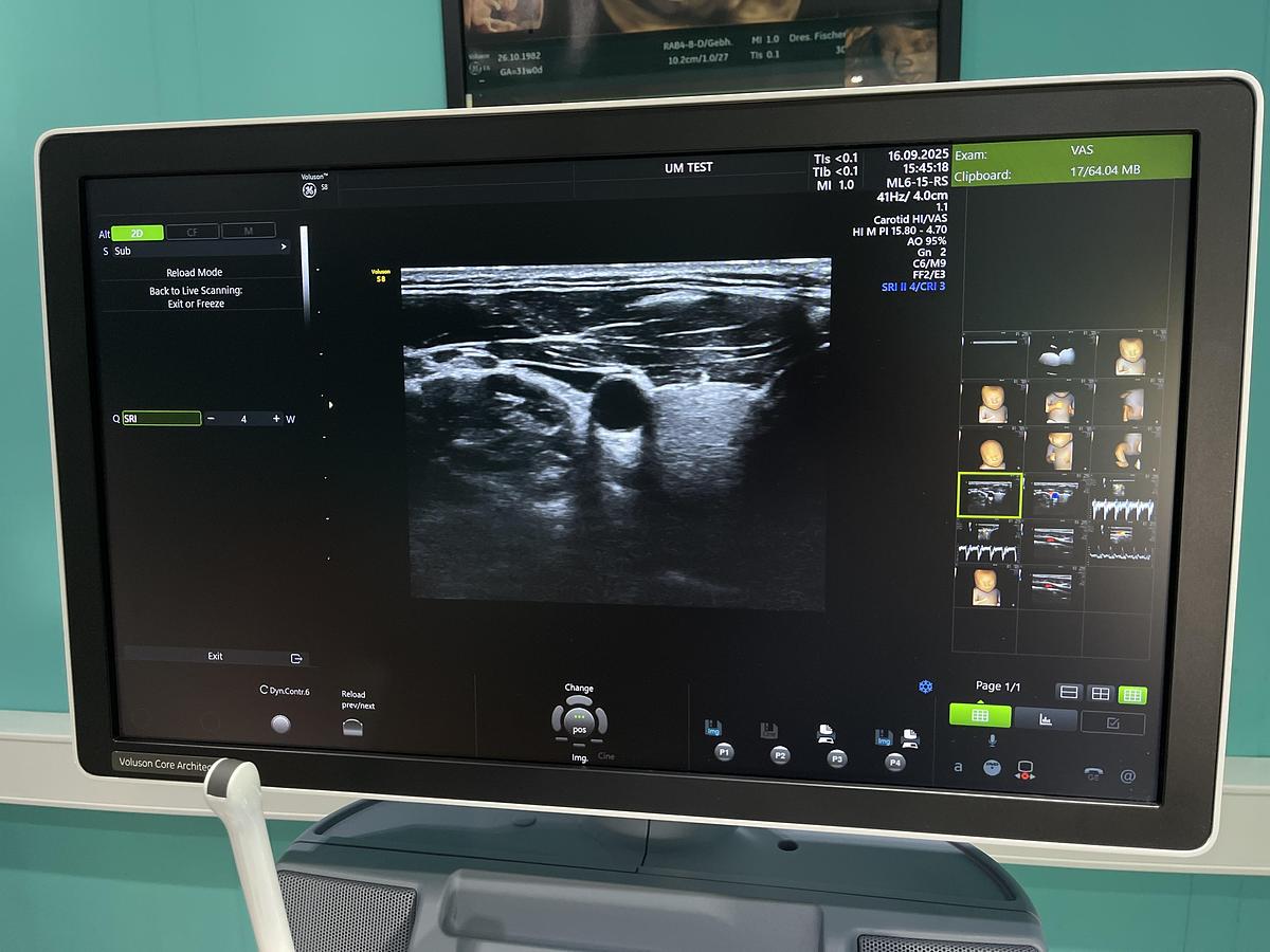 Gebraucht GE Voluson S8 Ultraschallgerät mit drei Sonden und Drucker