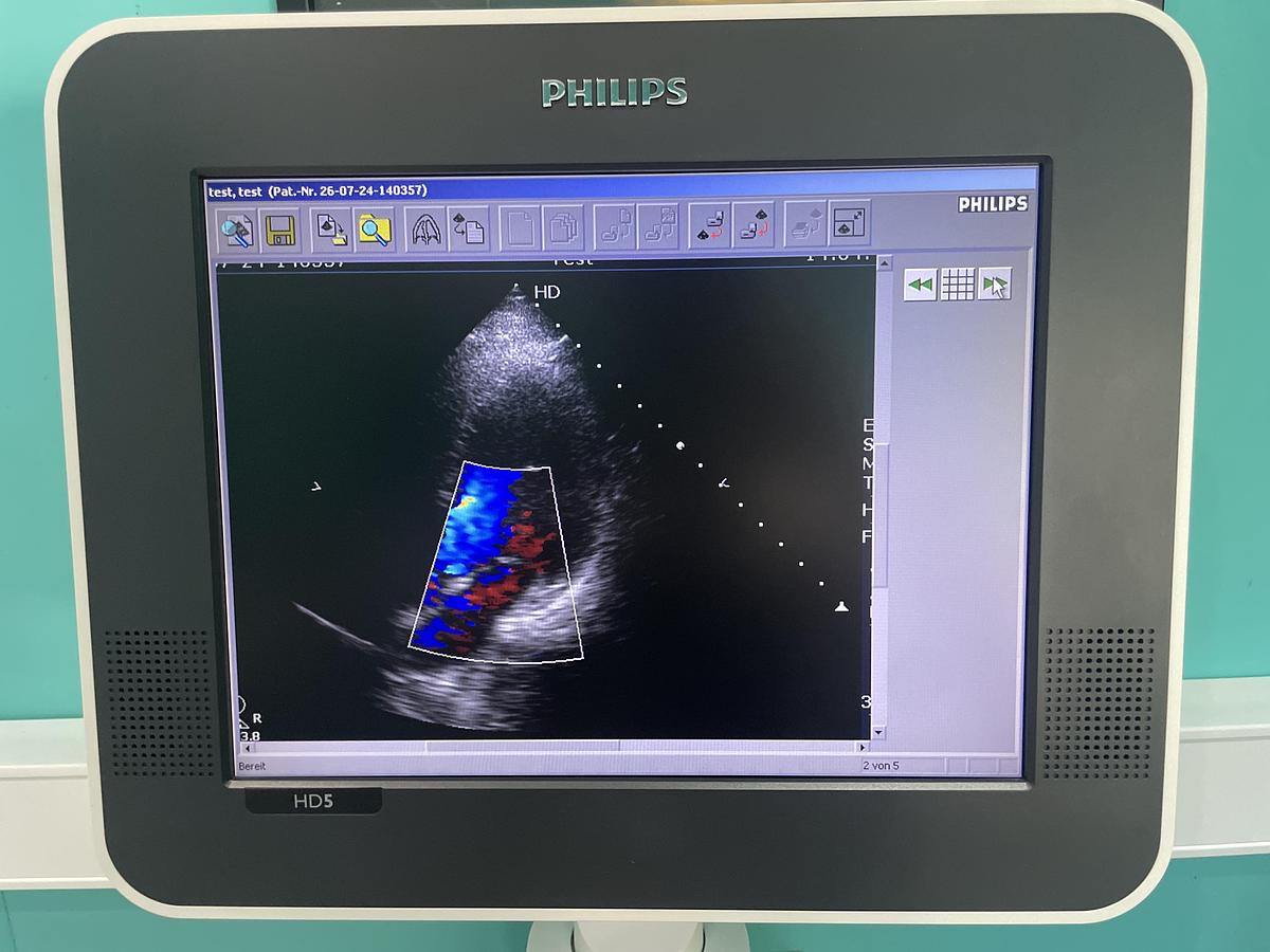 Gebraucht Philips HD5 Ultraschallgerät mit zwei Sonden und Drucker