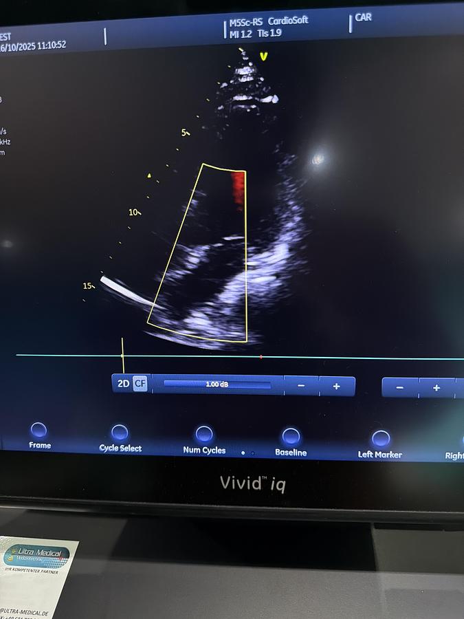 Gebraucht GE M5Sc-RS Kardio Ultraschallsonde
