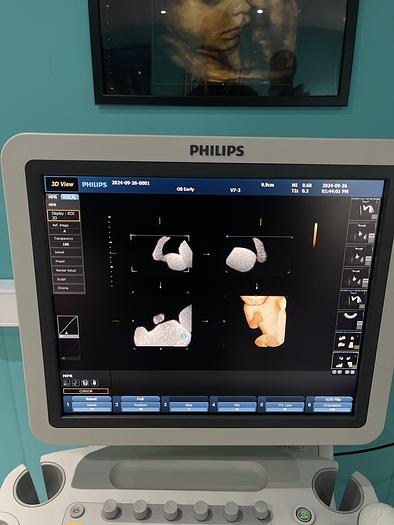 Used Philips HD9 Ultraschallgerät mit drei Sonden